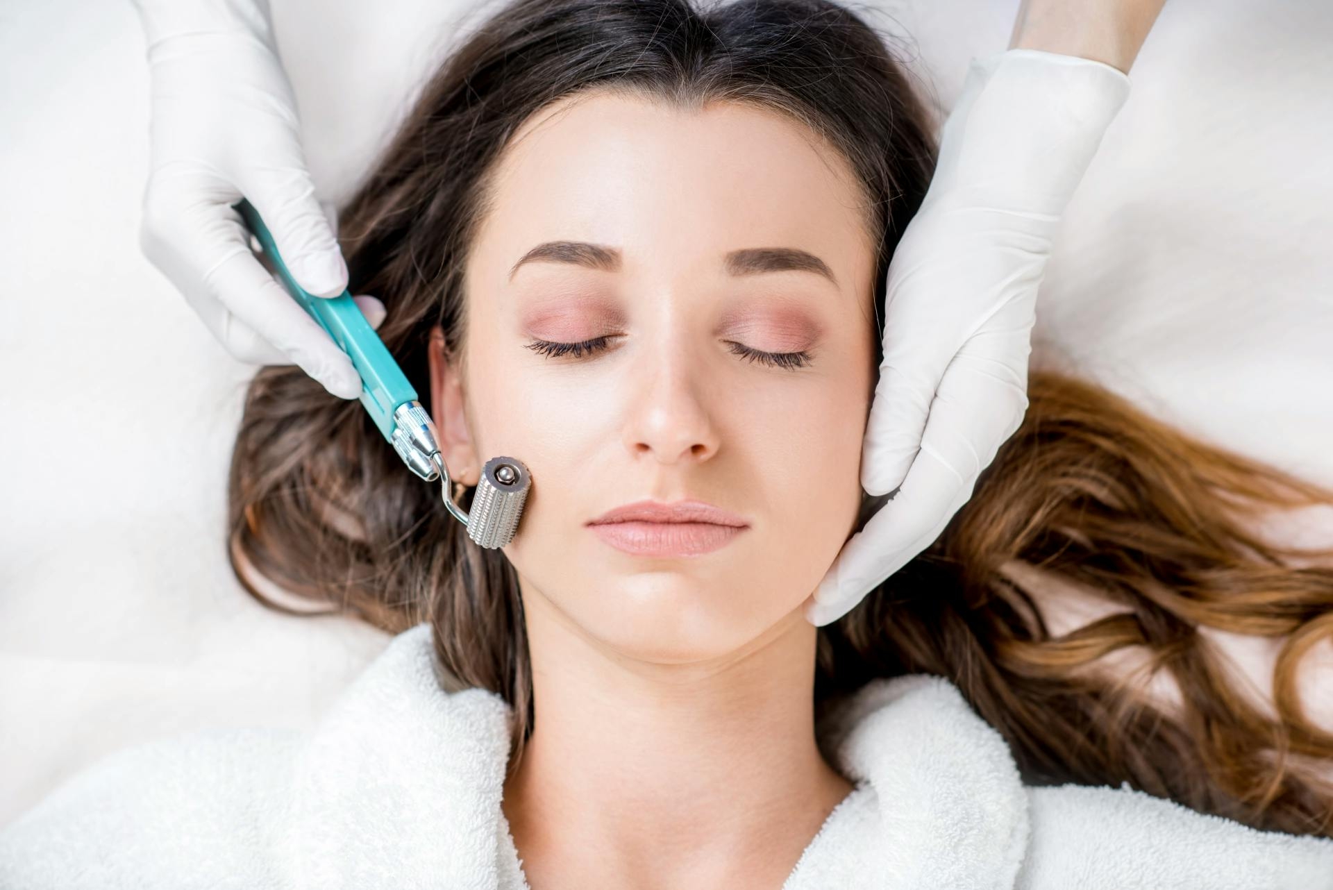 traitement microneedling fait sur une patiente